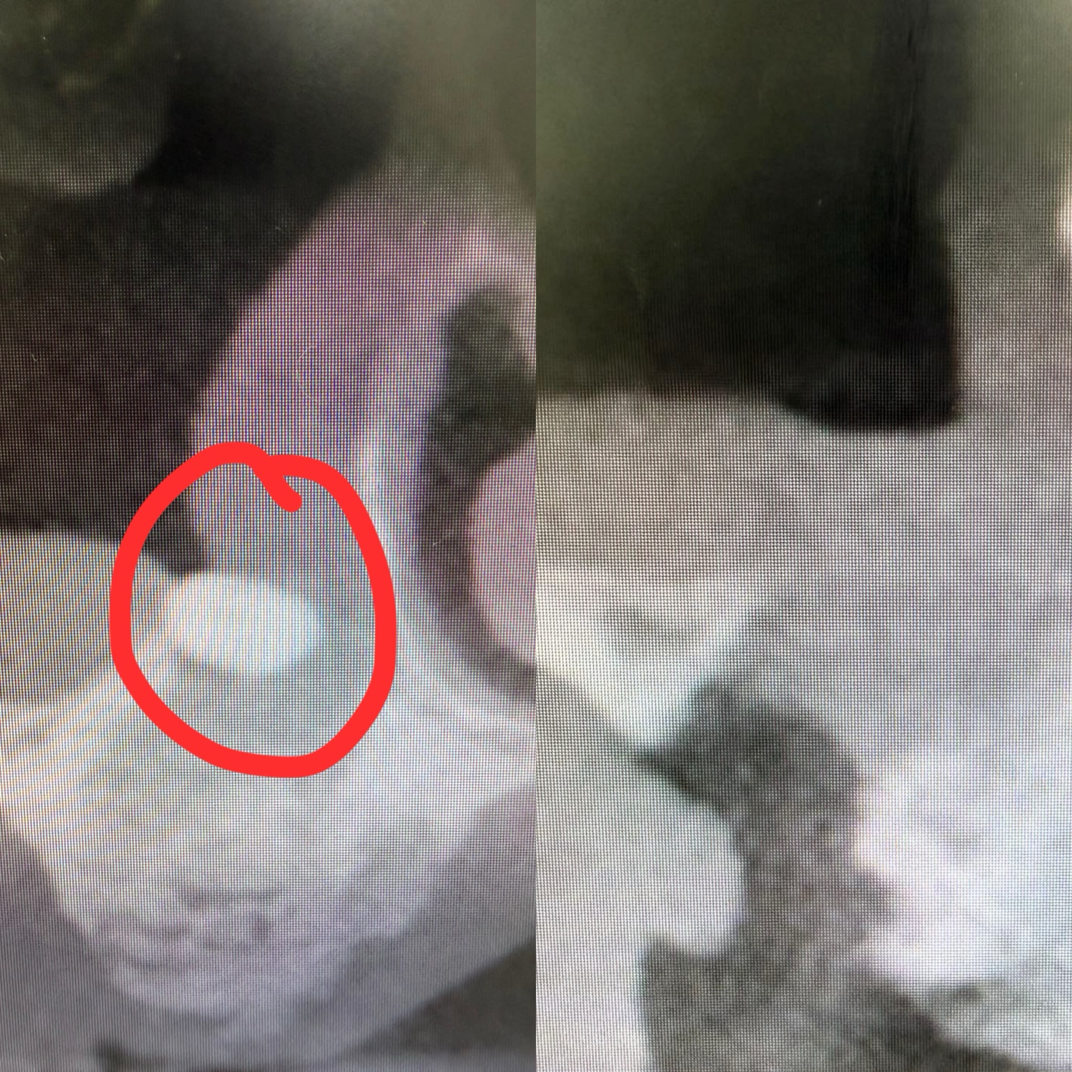 Root or implant retrieval from the sinus clinical case 1